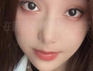 微密圈 - 在困惑中寻女神，奶雯图包分享，难道只是一场梦？